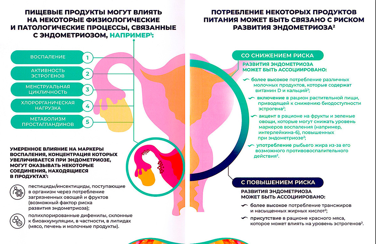 Рис. 2. Эндометриоз